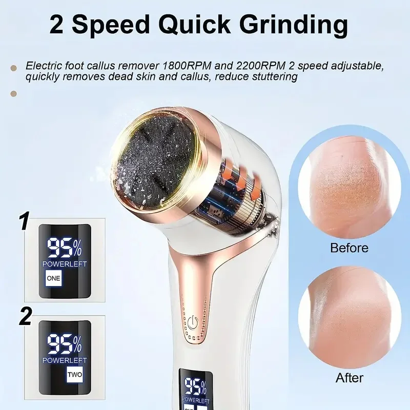 Professional Electric Callus Remover For Feet – Rechargeable Foot Care Kit With 3 Heads, Dander Vacuum Cleaner, LCD Display Professional Electric Callus Remover For Feet - Rechargeable Foot Care Kit With 3 Heads, Dander Vacuum Cleaner, LCD Display