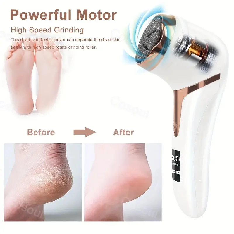 Professional Electric Callus Remover For Feet – Rechargeable Foot Care Kit With 3 Heads, Dander Vacuum Cleaner, LCD Display Professional Electric Callus Remover For Feet - Rechargeable Foot Care Kit With 3 Heads, Dander Vacuum Cleaner, LCD Display